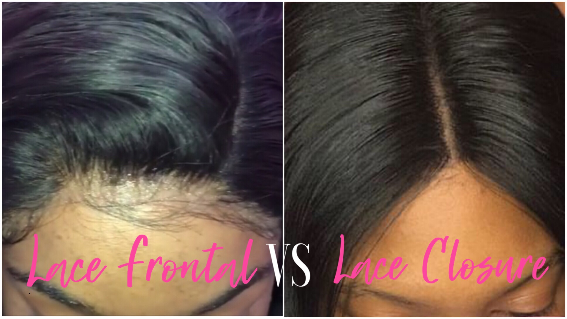 What's the difference between a lace closure and a lace frontal